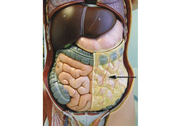 腹腔鏡大網膜示意圖。（圖片提供／彰化基督教醫院）