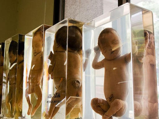 Hii.. Bangkok Punya Museum yang Pajang Mayat Bayi!