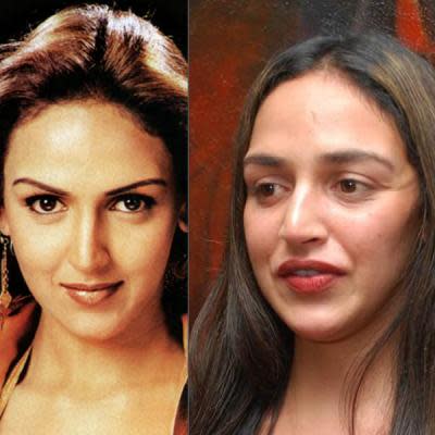 Bollywood Celebrity Lip Jobs that Failed to Impress