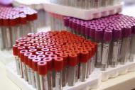 (Arquivo) Ampolas de exame de sangue são vistas em Paris, no dia 6 de julho de 2012