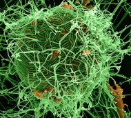 Terrorists have threatened to release Ebola virus in Czech Republic.