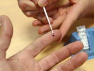 Teste de hepatite C é realizado em um hospital da França
