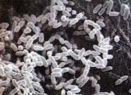 A bacteria Burkholderia pseudomallei