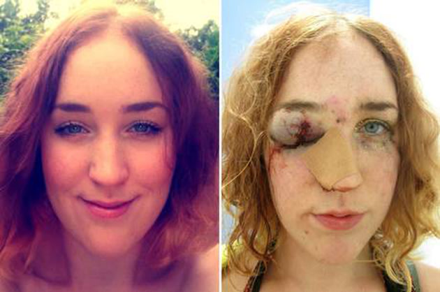 A selfie da agressão está ajudando mulheres a se sentirem seguras para denunciar