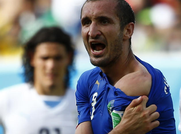 Italy's Giorgio Chiellini shows his shoulder, claiming he was bitten by Uruguay's Luis Suarez, during their 2014 World Cup Group D soccer match at the Dunas arena in Natal