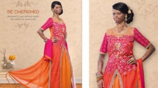 印度婦女恩莎遭潑酸毀容後，沒有選擇整型，而是以殘缺的顏面示人，最後還為印度服飾品牌代言，十分鼓舞人心。（photo by 翻攝《BBC》）