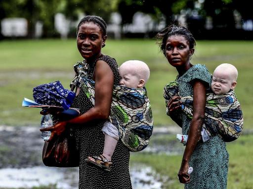 Mulheres carregam filhos albinos na Tanzânia