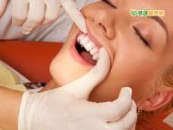 口腔出現白斑　小心為口腔癌徵兆