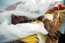 Un joven de 18 años con fiebre amarilla fotografiado el 14 de noviembre de 2012 en El-Geneina, Sudán