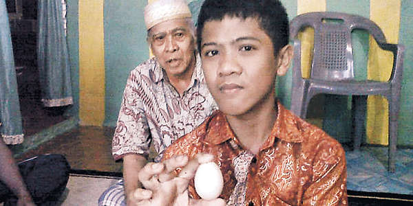 印尼男童「連疴」7蛋  世界奇闻