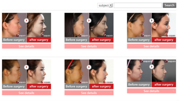 more-singaporeans-flying-to-seoul-for-plastic-surgery-singapore