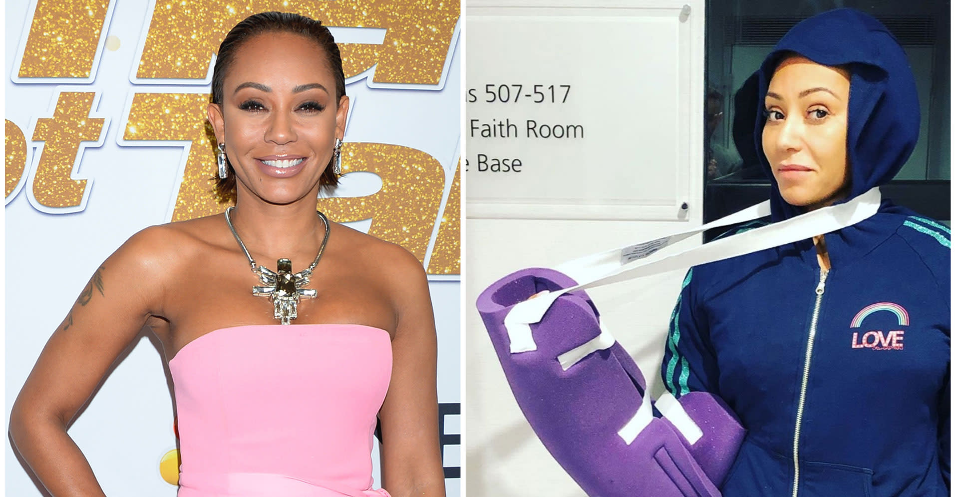 Mel B Rushed To Hospital With Broken Ribs And Severed Hand Aol