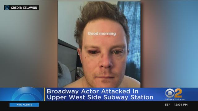 Broadway Actor Attacked In Upper West Side Subway Station