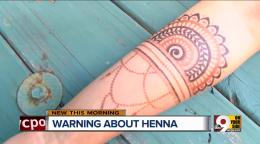 Trying To Make Your Henna Tattoo Last Longer Can Badly Damage Your Skin